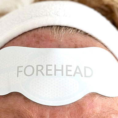 super sculpt facelift